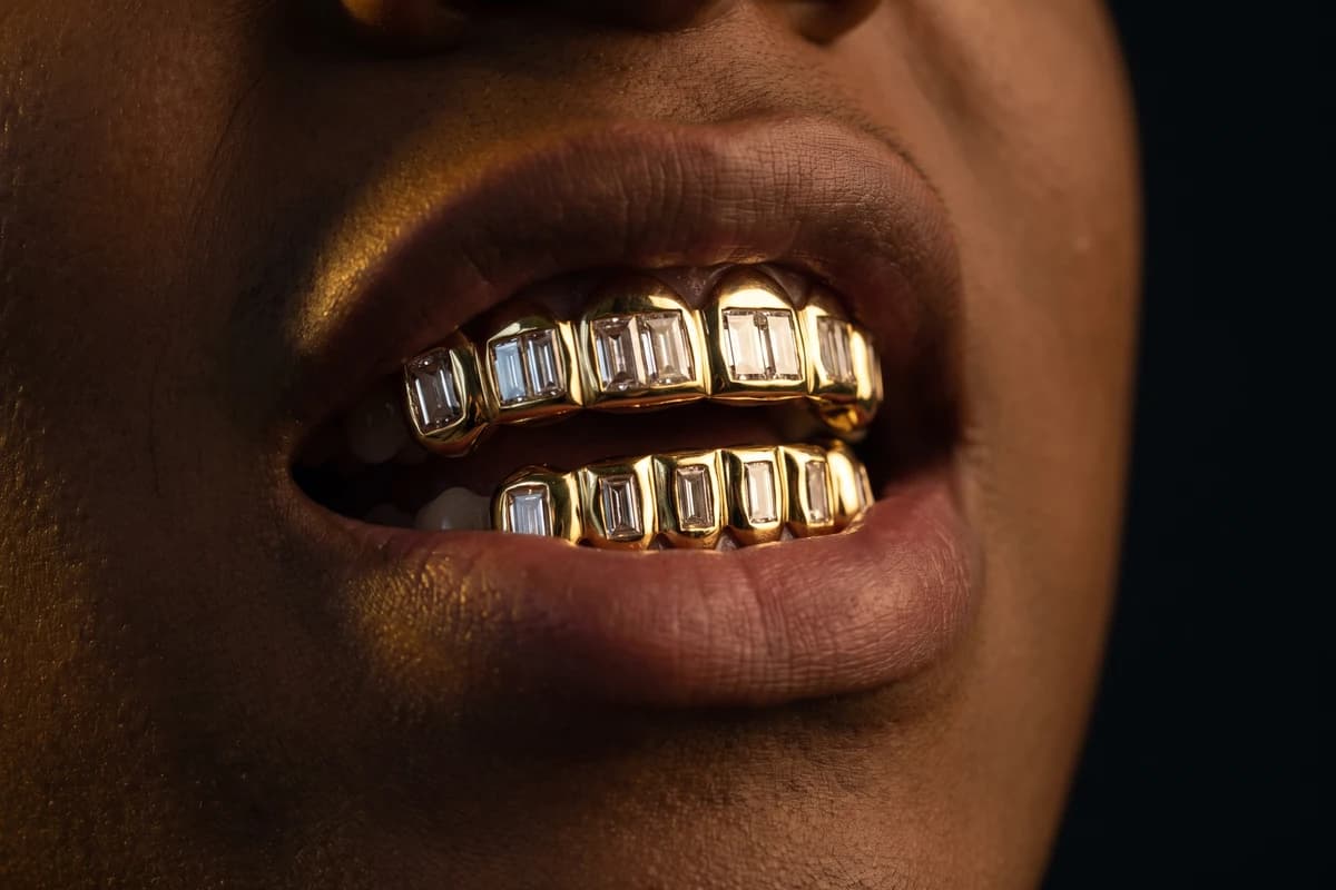 Design prototype — a rendering of matching top and bottom yellow gold grillz set with baguette diamonds, worn over the upper and lower teeth, a piece ATL Luxury Jewelry can make for you.